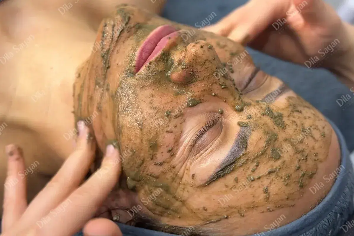 İskandinav Peeling uygulaması